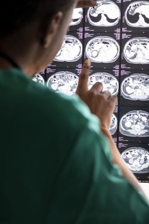 Doctor reading brain MRI x-ray result